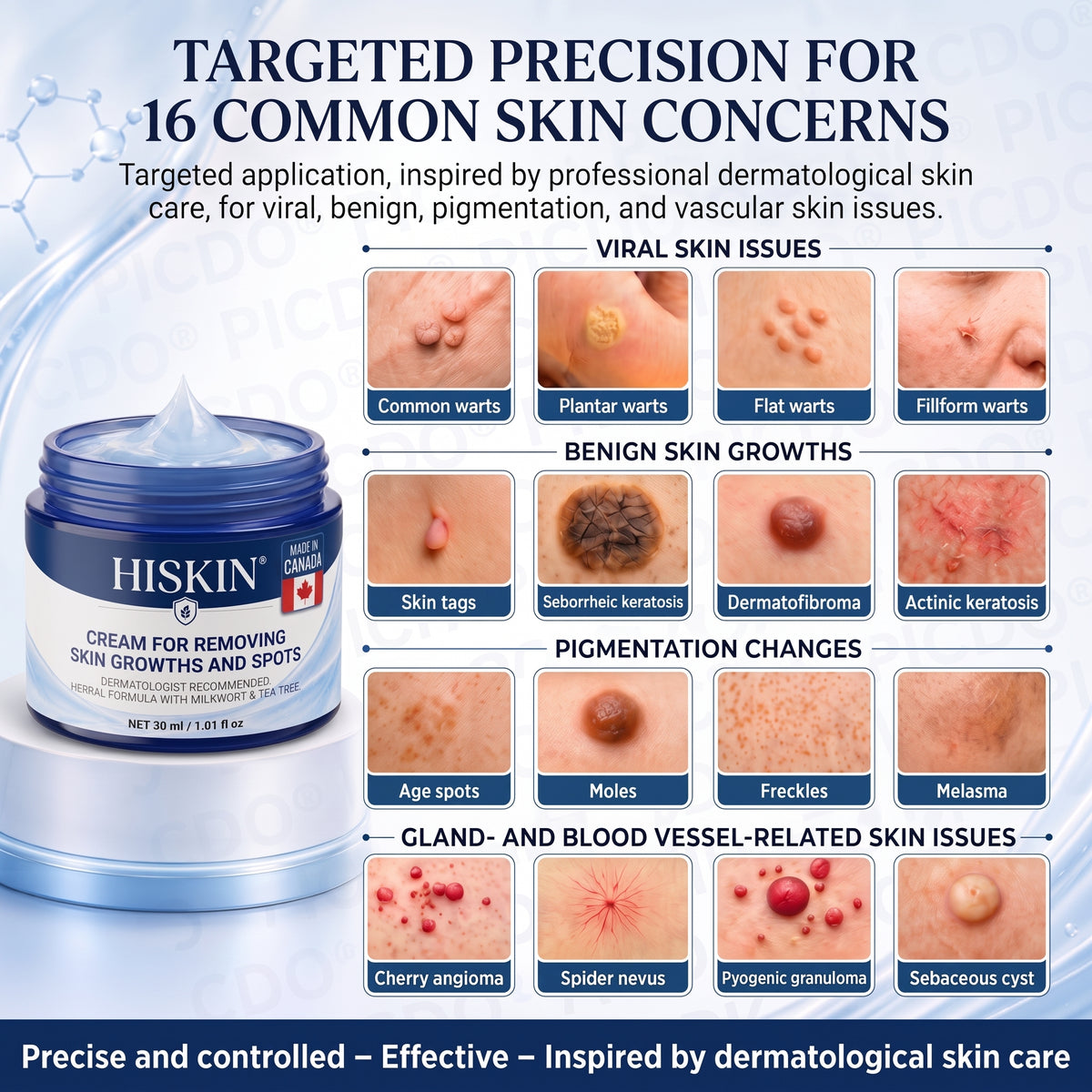 HISKIN® 10-in-1 Targeted Skin Tag & Dark Spot Cream – 7-Day Painless, Scar-Free Herbal Formula